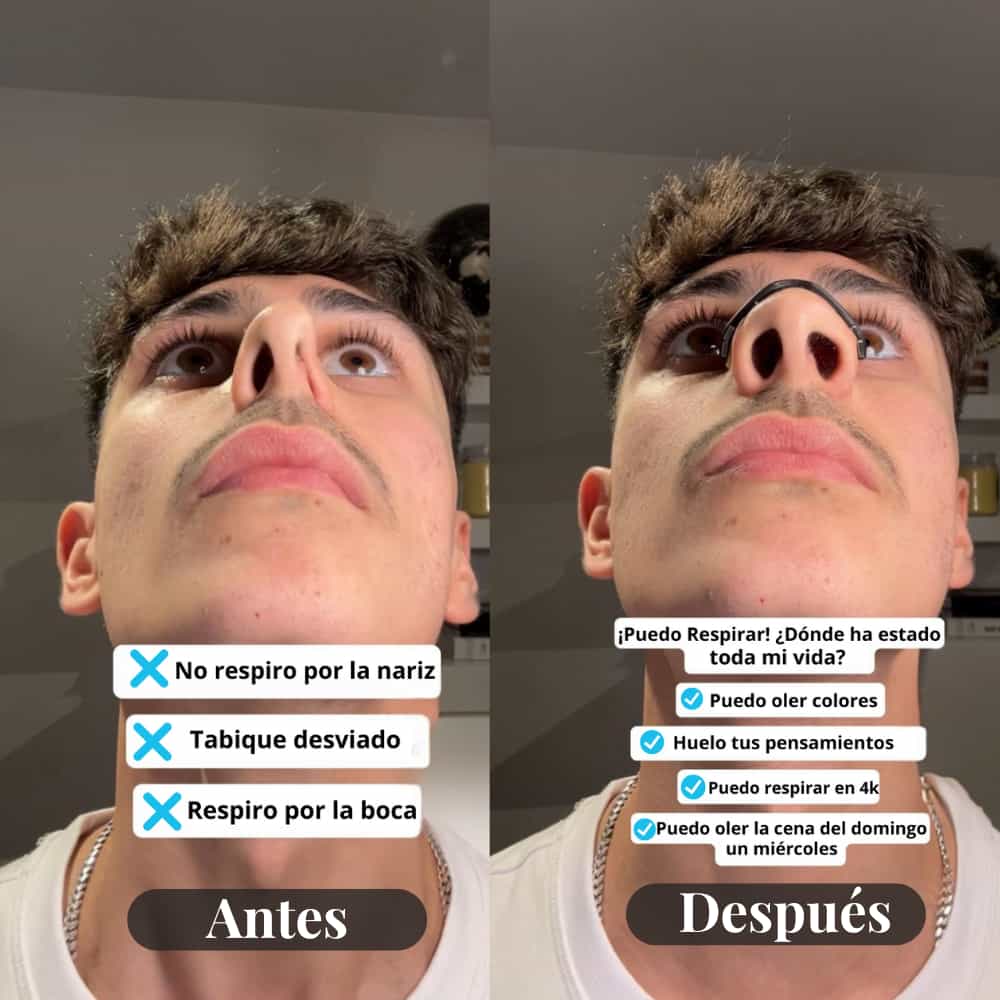 Dilatador Nasal - Respiración Oxigenada