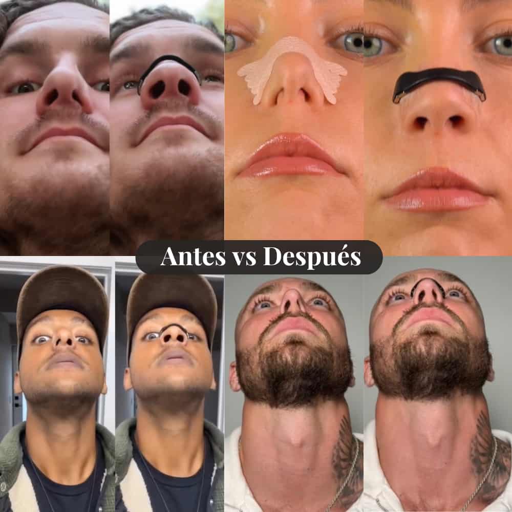Dilatador Nasal - Respiración Oxigenada
